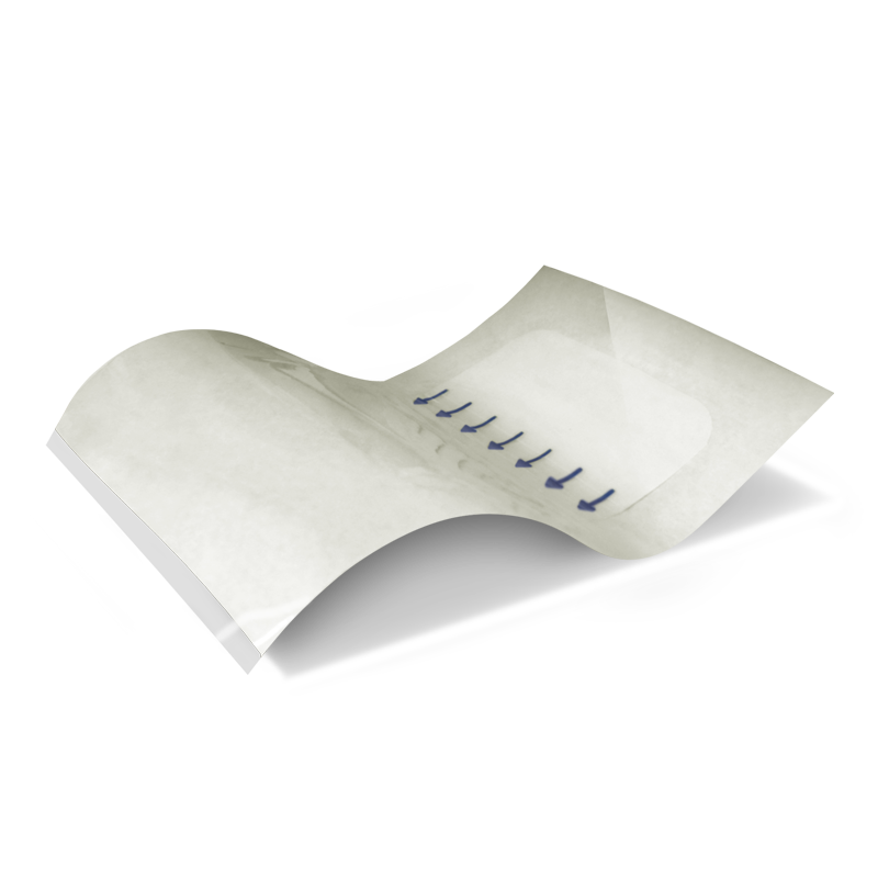 Filme Transparente Estéril Wound Care F – PolarFix (10 x 25 cm)