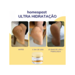 Creme de Hidratação HomeoPast (30g)