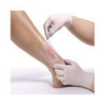 Curativo Membracel 10x7,5 cm - Vuelo