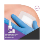 Removedor de Adesivos e Curativos em Spray (30ml) – Rioquímica